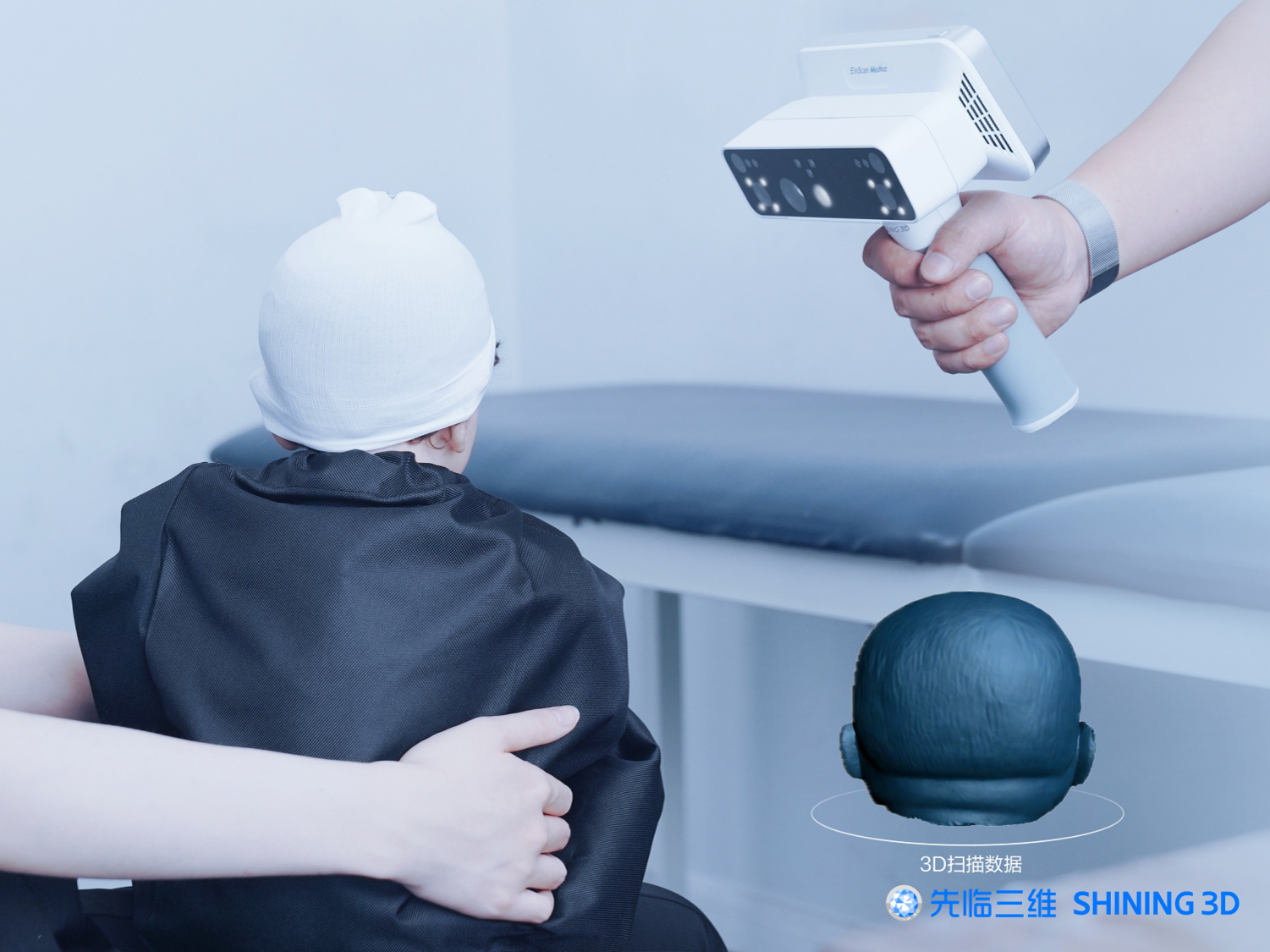 Kaiyun：人体测量新方案先临三维新品EinScan Medixa双光源无线D扫描仪重磅来袭！(图3)